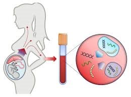 Nipt Test