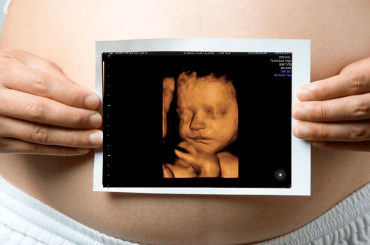 3D / 4D Ultrasound in Pregnancy